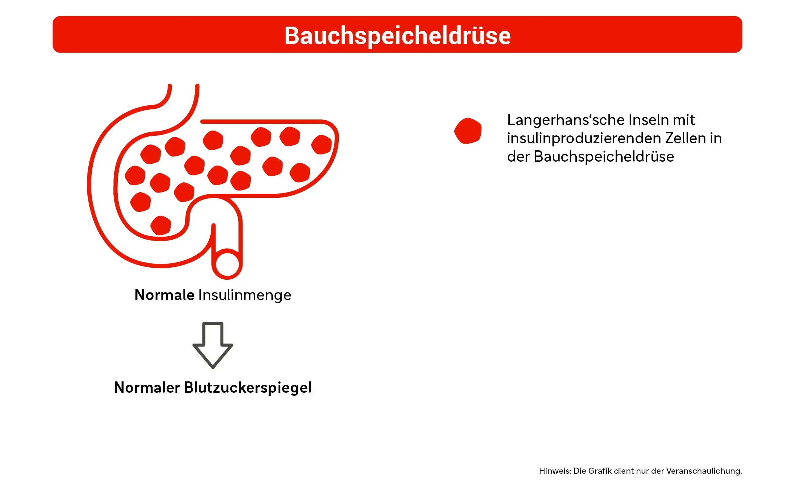 Grafik: Die Bauchspeicheldrüse
