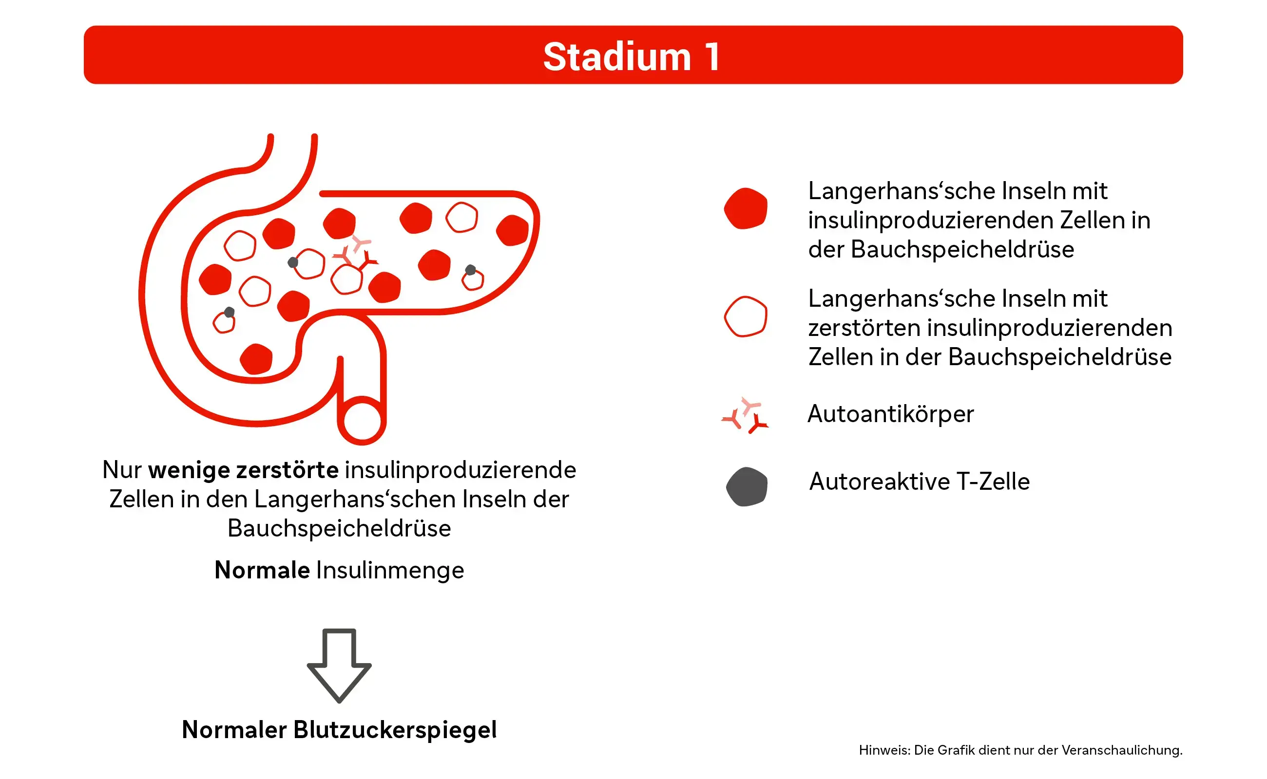 Grafik: Stadium 1