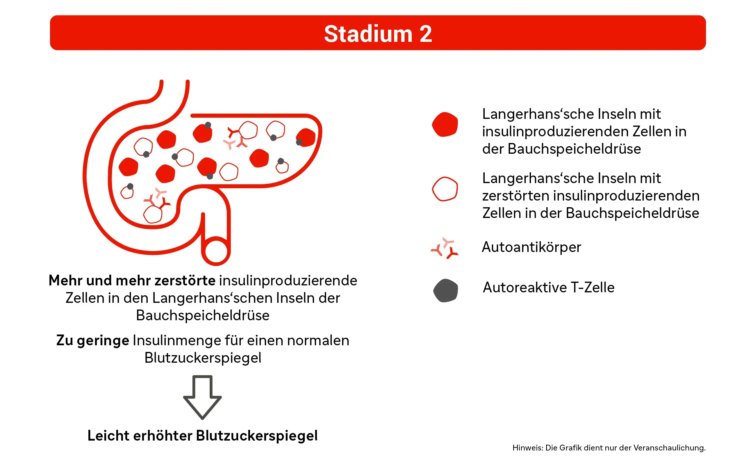 Grafik: Stadium 2