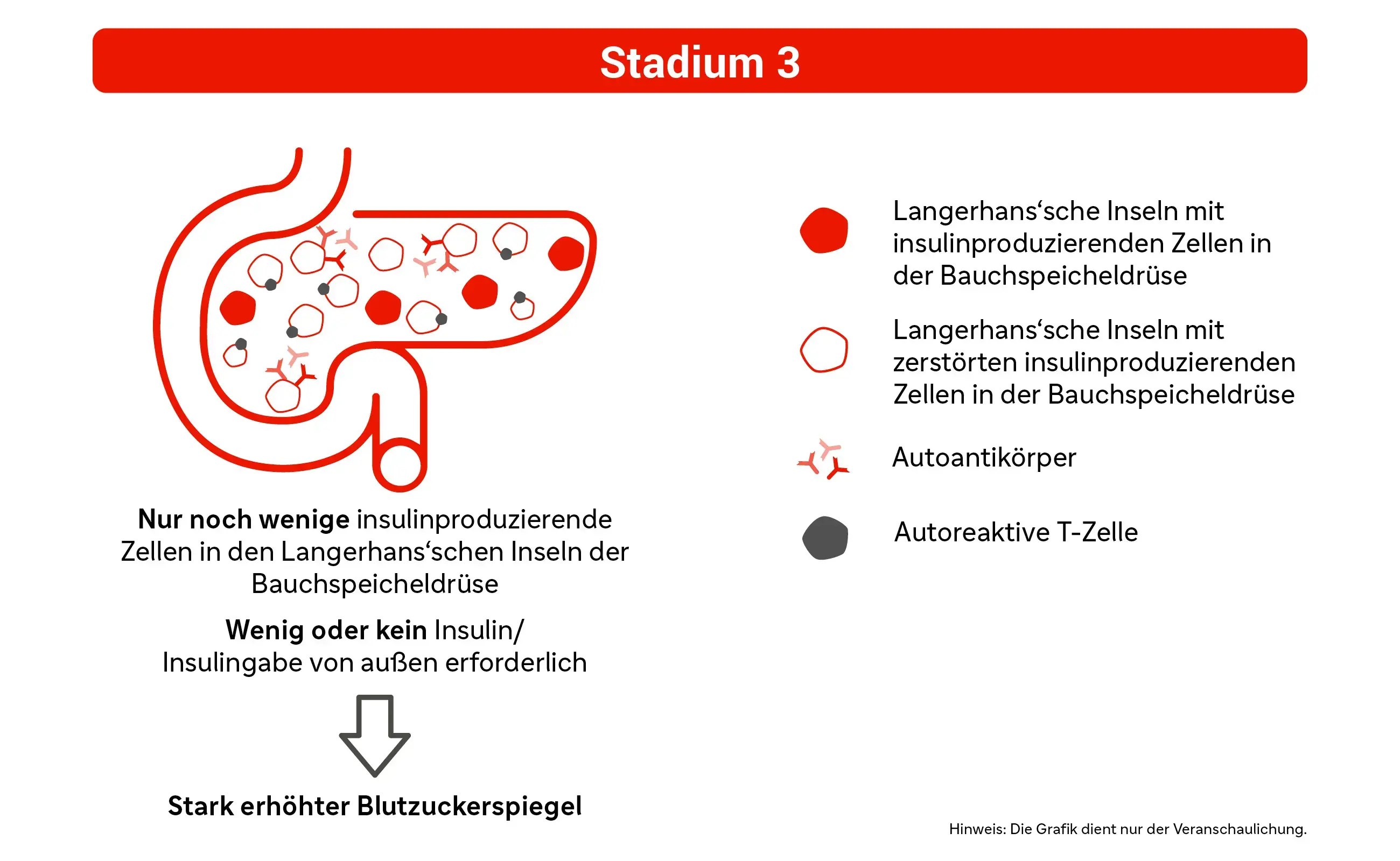 Grafik: Stadium 3
