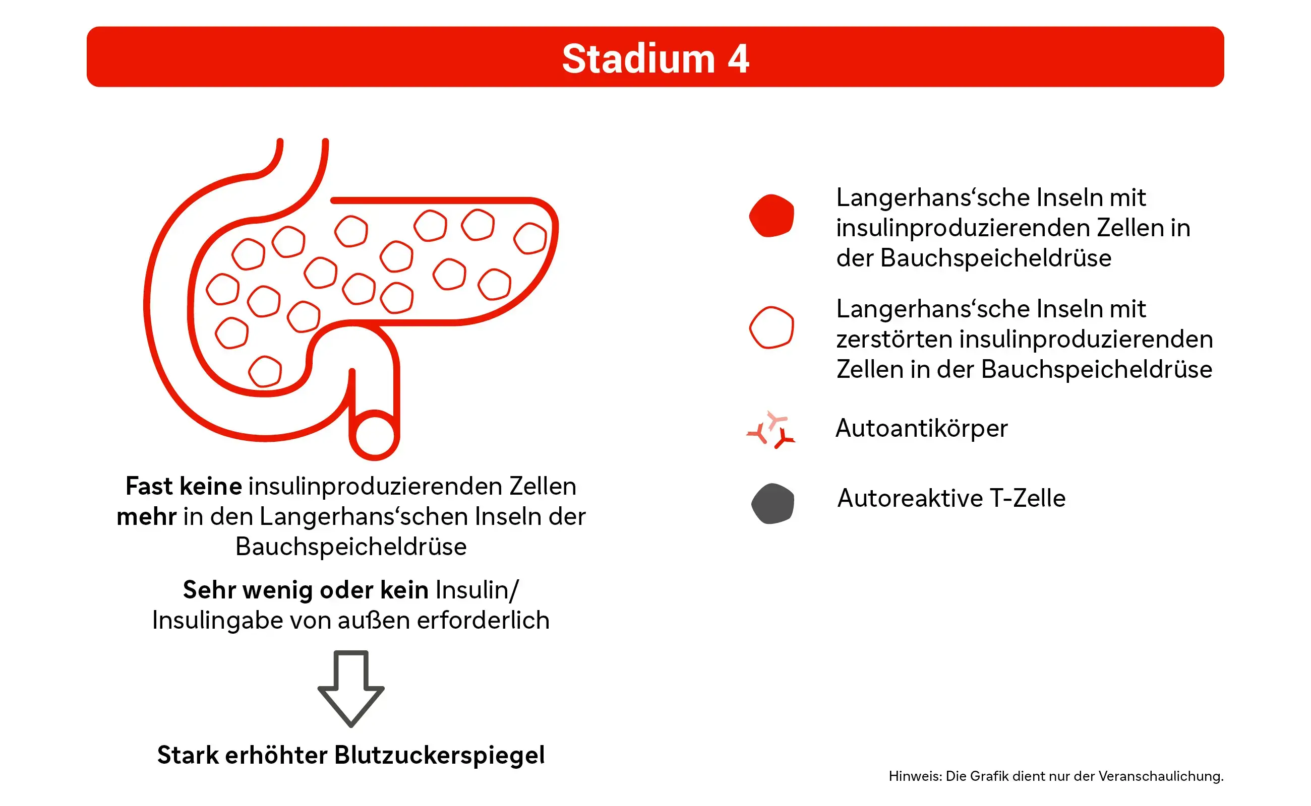 Grafik: Stadium 4