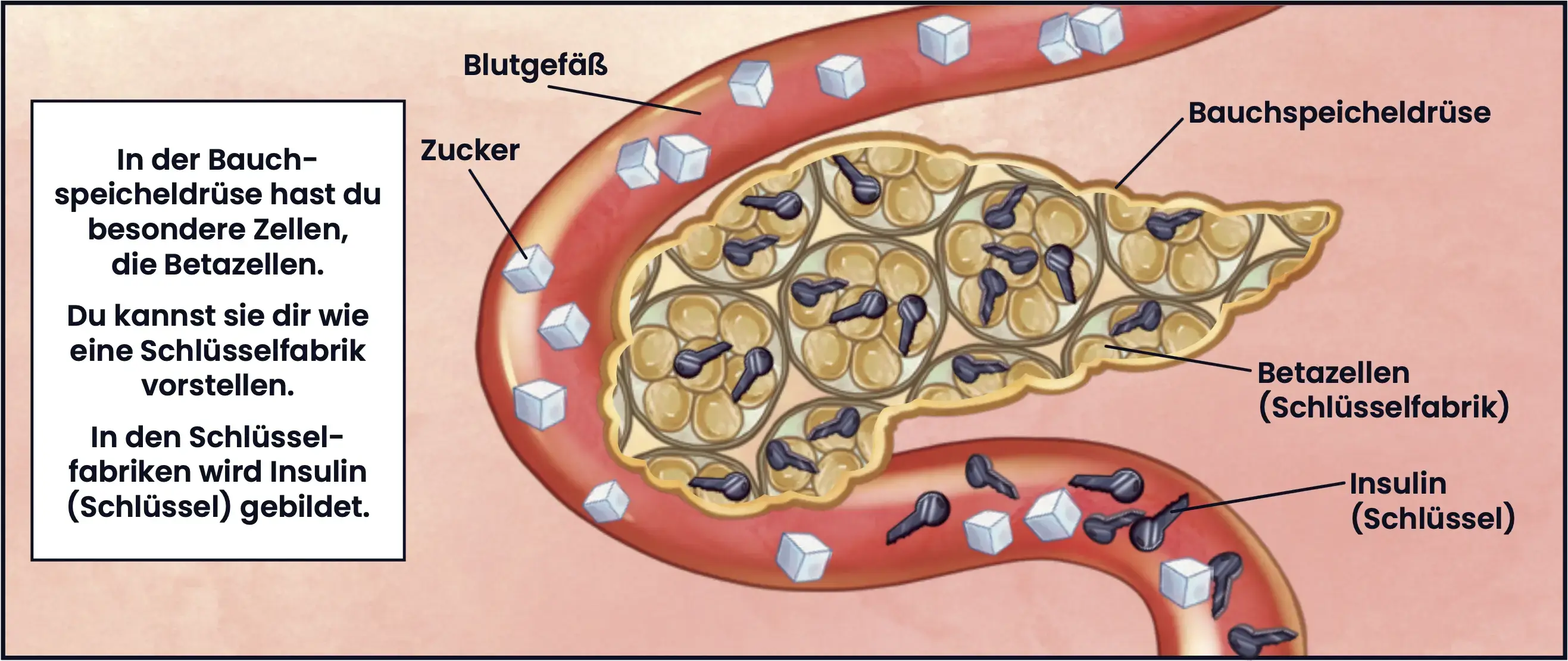 Illustration von:Blutgefäß, Zucker, Bauchspeicheldrüse, Betazellen und Insulin. In der Bauchspeicheldrüse hast du besondere Zellen, die Betazellen. Du kannst sie dir wie eine Schlüsselfabrik vorstellen. In den Schlüsselfabriken wird Insulin (Schlüssel) gebildet.